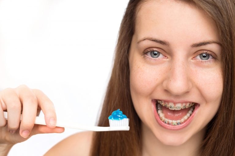 Braces and Gingivitis