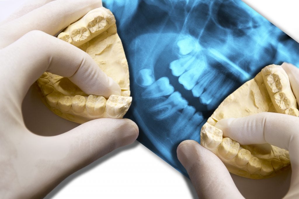 hands show molar teeth over x-ray dental scan