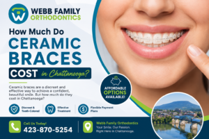 How Much Do Ceramic Braces Cost in Chattanooga?