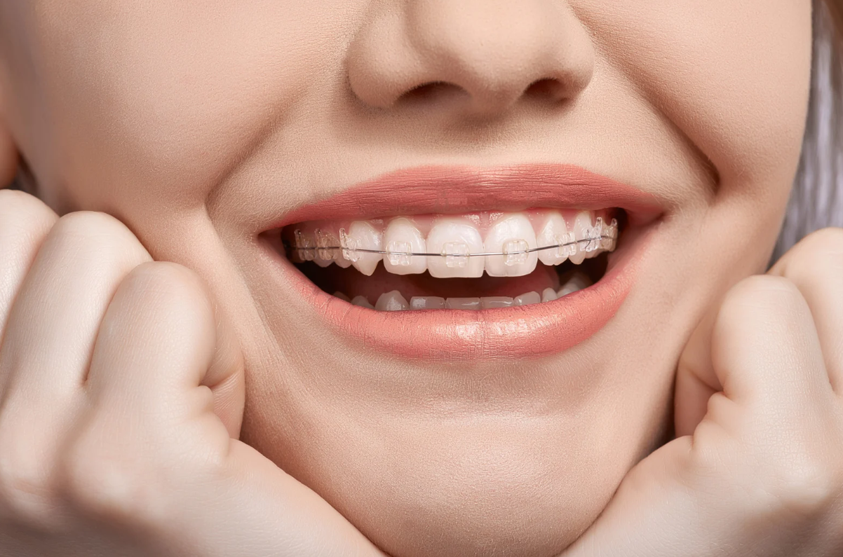 How Much Do Braces Cost in Dayton, TN?