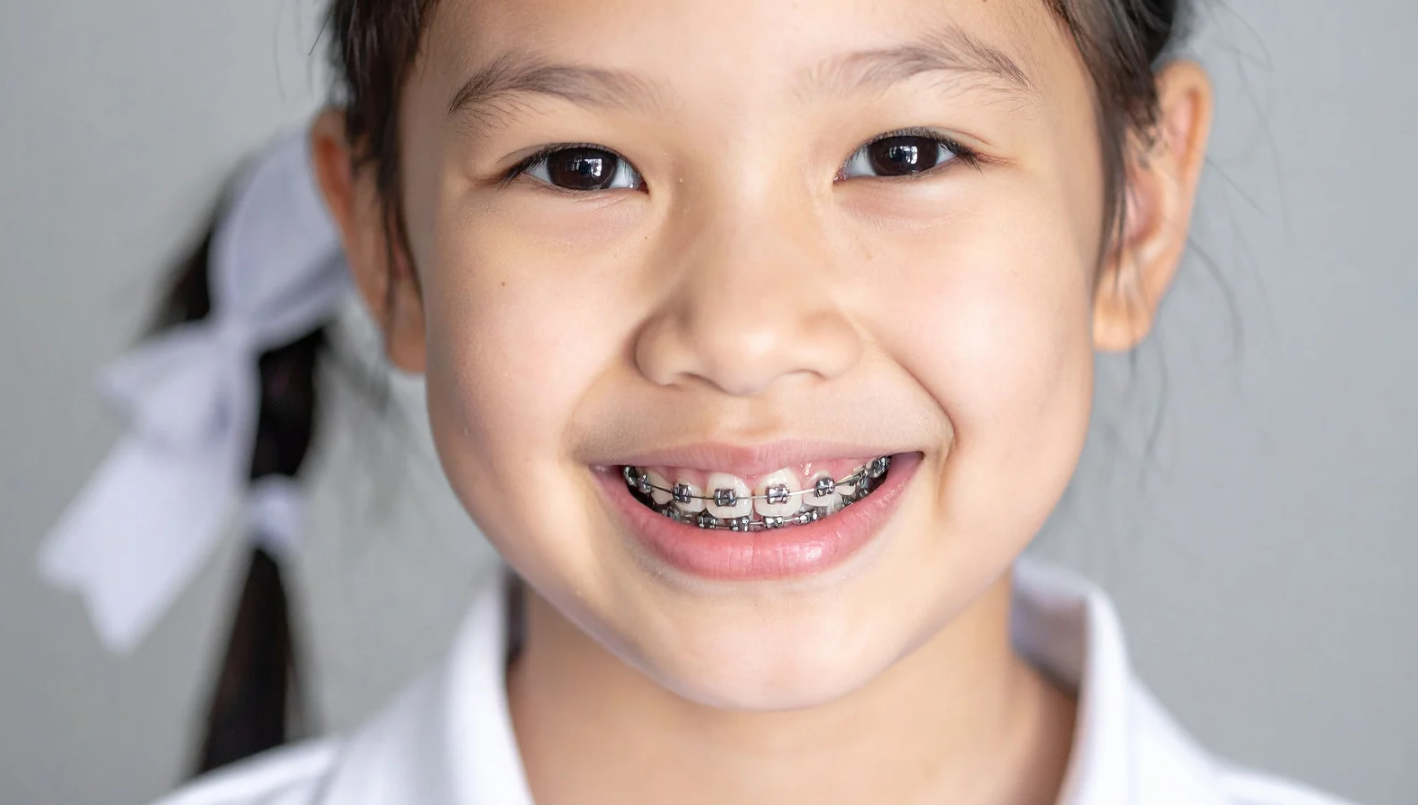 Braces for Kids vs Teens vs Adults in Dayton